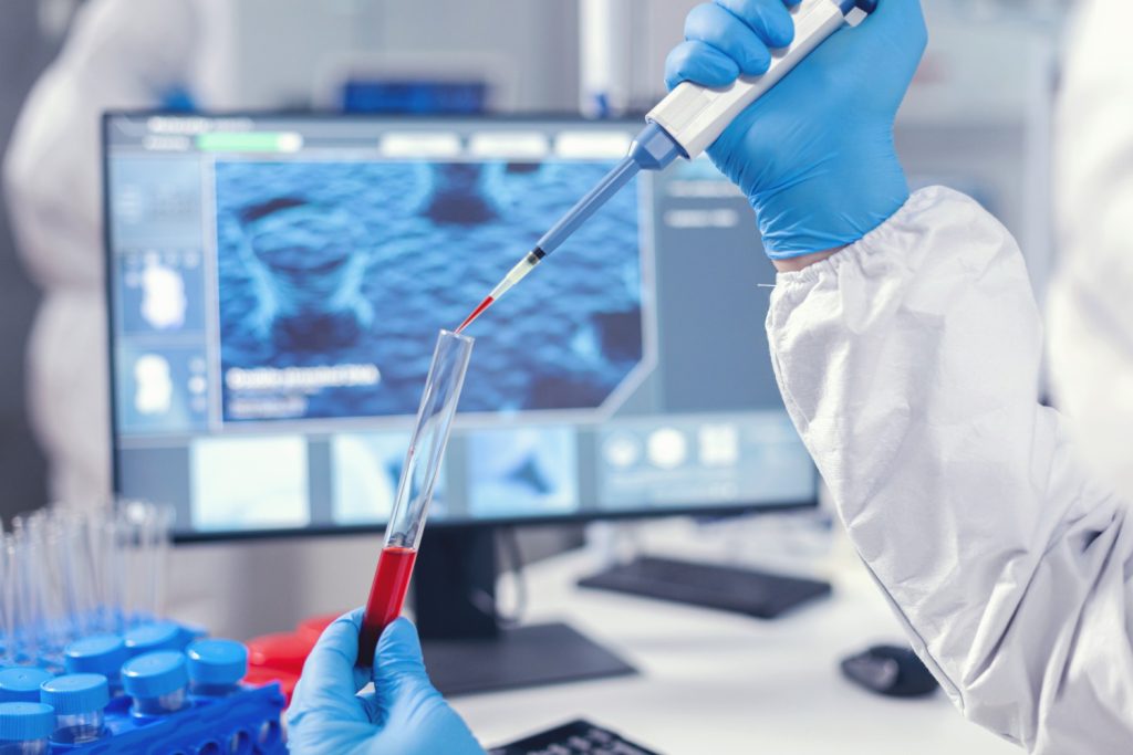 Ekstraksi sampel darah menggunakan pipet mikroliter untuk pemeriksaan biomolekuler virus Hanta.